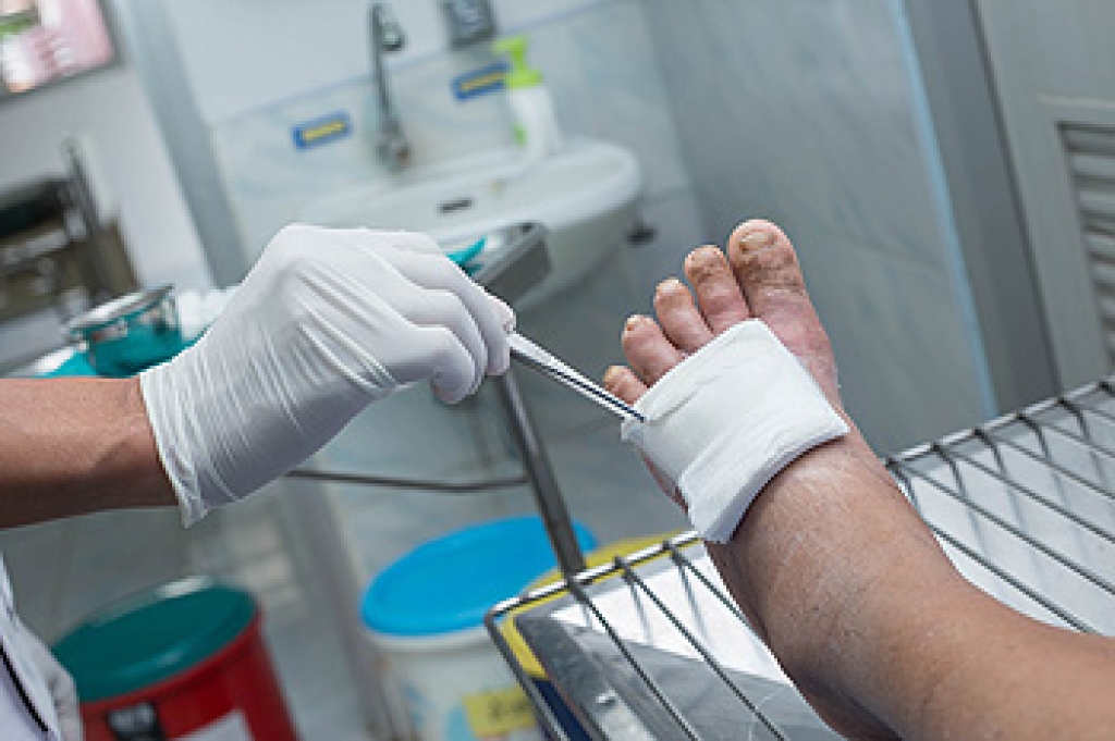 Protecting Your Feet From Diabetic Foot Ulcers