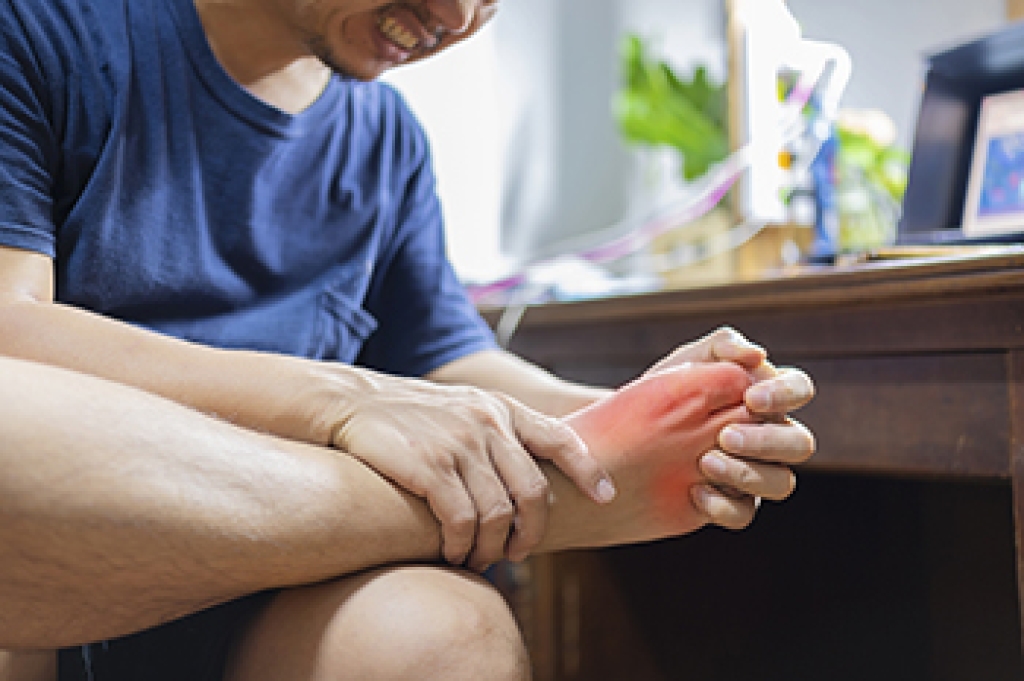 Dealing With the Pain of Gout