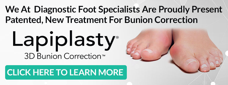 lapiplasty banner
