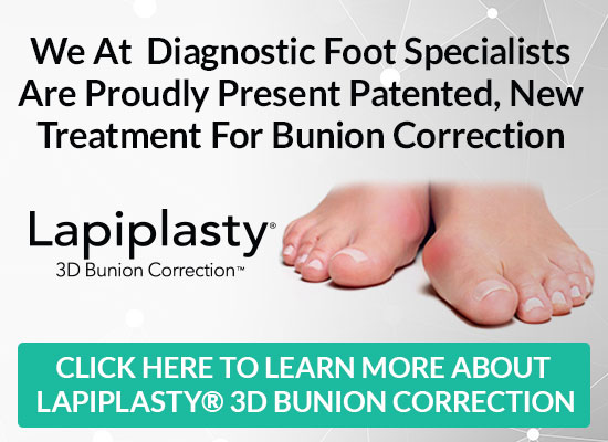 lapiplasty banner