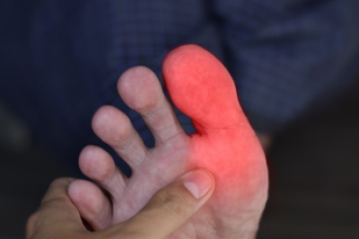 Managing Hallux Rigidus and Preserving Joint Function