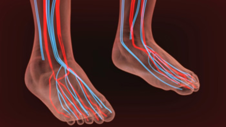 Identifying and Managing Poor Foot Circulation