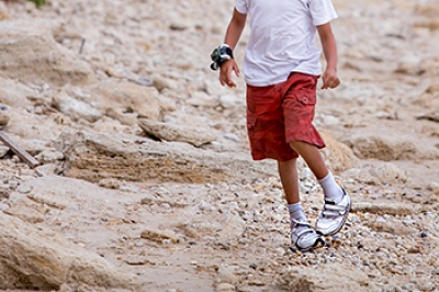 Understanding Congenital Foot Deformities in Children